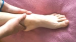 Ayak Bileğindeki Değişim: Kalp Yetmezliğine Dikkat!